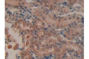 Immunohistochemistry (IHC) image for anti-CD274 (PD-L1) (AA 34-241) antibody (ABIN7440449)
