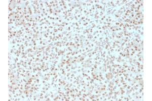 Formalin-fixed, paraffin-embedded human Pancreas stained with AKT1 Mouse Monoclonal Antibody (AKT1/2491). (AKT1 抗体  (AA 85-189))