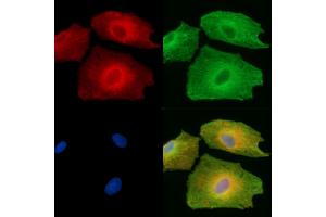 ABIN7096287 and ABIN7100349 staining  cells by IF/ICC.