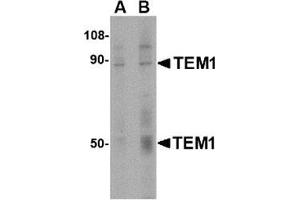 Western blot analysis of TEM1 in human colon tissue lysate with this product at (A) 0. (CD248 抗体  (C-Term))