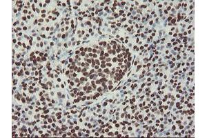 Image no. 4 for anti-Non-POU Domain Containing, Octamer-Binding (NONO) (AA 184-385) antibody (ABIN1491073)