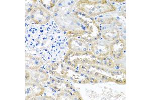 Immunohistochemistry of paraffin-embedded rat kidney using OGFR antibody at dilution of 1:100 (x40 lens). (OGFR 抗体)