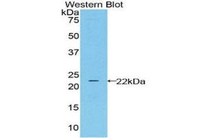 Western Blotting (WB) image for anti-Lipocalin 2 (LCN2) (AA 21-198) antibody (ABIN1078407) (Lipocalin 2 抗体  (AA 21-198))