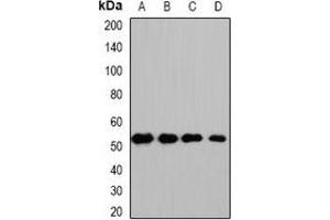 Western blot analysis of HS1BP3 expression in HepG2 (A), mouse kidney (B), mouse heart (C), rat liver (D) whole cell lysates. (HS1BP3 抗体)