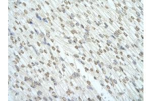 Rabbit Anti-RBM7 antibody   Paraffin Embedded Tissue: Human Heart cell Cellular Data: cardiac cell of renal tubule Antibody Concentration: 4. (RBM7 抗体  (Middle Region))