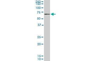 CROT monoclonal antibody (M01), clone 1A6. (CROT 抗体  (AA 2-99))