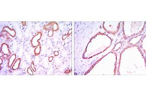 Immunohistochemical analysis of paraffin-embedded kidney tissues using HK1 mouse mAb with DAB staining. (Hexokinase 1 抗体)
