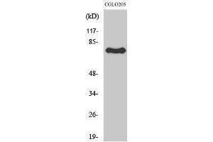 Western Blotting (WB) image for anti-Activating Transcription Factor 6 beta (ATF6B) (Internal Region) antibody (ABIN3183420) (ATF6B 抗体  (Internal Region))