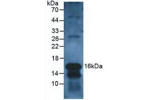 Detection of CLC in Human Leukocyte Cells using Polyclonal Antibody to Charcot Leyden Crystal Protein (CLC) (Galectin 10 抗体  (AA 2-142))