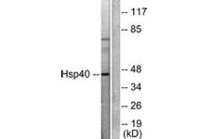 Western Blotting (WB) image for anti-DnaJ (Hsp40) Homolog, Subfamily B, Member 1 (DNAJB1) (AA 271-320) antibody (ABIN1533312)