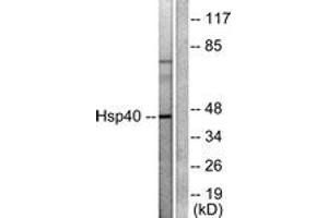 Western blot analysis of extracts from COLO205 cells, using HSP40 Antibody. (DNAJB1 抗体  (AA 271-320))