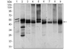 Western blot analysis using ILK mouse mAb against Jurkat (1), NIH3T3 (2), HeLa (3), PC-12 (4), C6 (5), COS7 (6), Raji (7), K562 (8) and MCF-7 (9) cell lysate. (ILK 抗体  (AA 97-244))