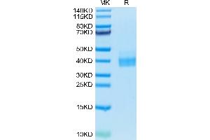 Biotinylated Human PD-L1 on Tris-Bis PAGE under reduced condition. (PD-L1 Protein (AA 19-238) (His-Avi Tag,Biotin))