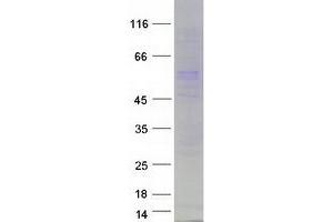 Western Blotting (WB) image for Preferentially Expressed Antigen in Melanoma (PRAME) (Transcript Variant 4) protein (Myc-DYKDDDDK Tag) (ABIN2729549)