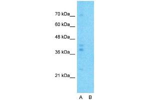Host:  Rabbit  Target Name:  G6PC  Sample Type:  Human Fetal Lung  Lane A:  Primary Antibody  Lane B:  Primary Antibody + Blocking Peptide  Primary Antibody Concentration:  1ug/ml  Peptide Concentration:  5ug/ml  Lysate Quantity:  25ug/lane/lane  Gel Concentration:  0. (G6PC 抗体  (N-Term))