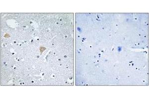 Immunohistochemistry analysis of paraffin-embedded human brain tissue, using CTRO Antibody. (CIT 抗体  (AA 1011-1060))