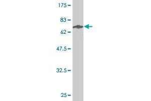 Western Blot detection against Immunogen (63. (STEAP1 抗体  (AA 1-339))