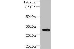 Western blot All lanes: CCDC127 antibody at 6 μg/mL + Mouse kidney tissue Secondary Goat polyclonal to rabbit IgG at 1/10000 dilution Predicted band size: 31 kDa Observed band size: 31 kDa (CCDC127 抗体  (AA 1-260))