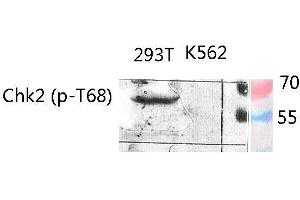 Western Blot (WB) analysis of specific lysis using Phospho-Chk2 (T68) Polyclonal Antibody. (CHEK2 抗体  (pThr68))