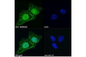 (ABIN6391406) Immunofluorescence analysis of paraformaldehyde fixed U2OS cells, permeabilized with 0. (Homeobox D13 抗体  (Internal Region))
