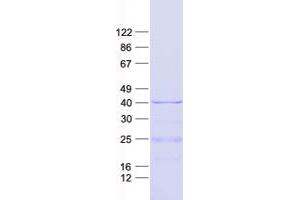 Western Blotting (WB) image for Mitochondrial Ribosomal Protein L4 (MRPL4) protein (His tag) (ABIN2726352)