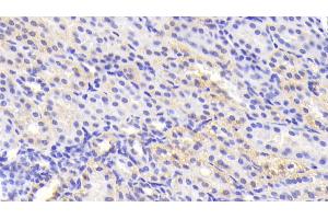Detection of TNKS2 in Human Kidney Tissue using Polyclonal Antibody to Tankyrase 2 (TNKS2) (TNKS2 抗体)