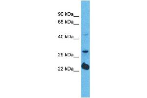 Western Blotting (WB) image for anti-Olfactory Receptor, Family 5, Subfamily D, Member 14 (OR5D14) (C-Term) antibody (ABIN2791753) (OR5D14 抗体  (C-Term))