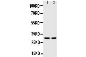 Anti-Kallikrein 1 antibody, Western blotting Lane 1: Rat Pancreas Tissue Lysate Lane 2: Rat Kidney Tissue Lysate