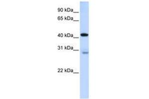 Image no. 1 for anti-GRAM Domain Containing 2 (GRAMD2) (AA 144-193) antibody (ABIN6740892) (GRAMD2 抗体  (AA 144-193))
