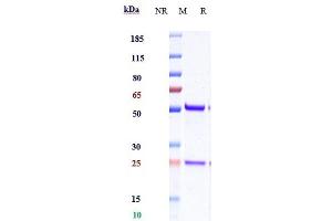 Anti-IL-15 Reference Antibody (DISC0280) on SDS-PAGE under reducing (R) condition.
