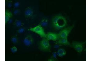 Anti-ACAT2 mouse monoclonal antibody (ABIN2452686) immunofluorescent staining of COS7 cells transiently transfected by pCMV6-ENTRY ACAT2 (RC201821). (ACAT2 抗体)