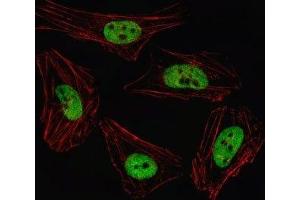 Fluorescent image of HeLa cell stained with PITX2 antibody.