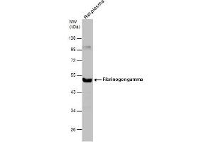 WB Image Rat tissue extract (50 μg) was separated by 10% SDS-PAGE, and the membrane was blotted with Fibrinogen gamma antibody , diluted at 1:500. (FGG 抗体)