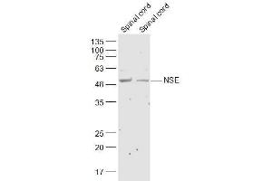 Lane 1: Mouse Spinal cord lysates Lane 2: Rat Spinal cord lysates probed with NSE Polyclonal Antibody, Unconjugated  at 1:300 dilution and 4˚C overnight incubation. (ENO2/NSE 抗体  (AA 201-300))