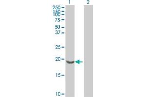 Western Blot analysis of SNCB expression in transfected 293T cell line by SNCB MaxPab polyclonal antibody. (beta Synuclein 抗体  (AA 1-134))