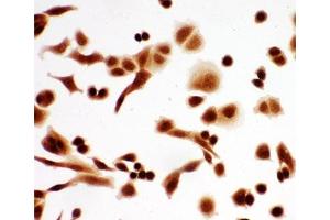 ICC testing of A549 cells