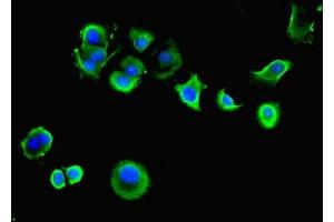 Immunofluorescent analysis of MCF-7 cells using ABIN7143931 at dilution of 1:100 and Alexa Fluor 488-congugated AffiniPure Goat Anti-Rabbit IgG(H+L) (SGCA 抗体  (AA 24-290))
