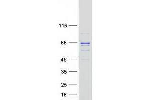 Validation with Western Blot
