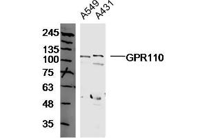Human A549 and A431 cell lysates probed with GPR110 Polyclonal Antibody, unconjugated  at 1:300 overnight at 4°C followed by a conjugated secondary antibody at 1:10000 for 90 minutes at 37°C. (G Protein-Coupled Receptor 110 抗体  (AA 51-150))