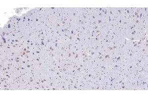 Detection of CC16 in Human Cerebrum Tissue using Monoclonal Antibody to Clara Cell Protein 16 (CC16) (SCGB1A1 抗体  (AA 23-91))