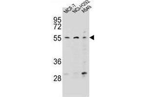 ZNF117 Antibody (N-term) western blot analysis in MCF-7,NCI-H292,A549 cell line lysates (35 µg/lane). (Zinc Finger Protein 117 抗体  (N-Term))