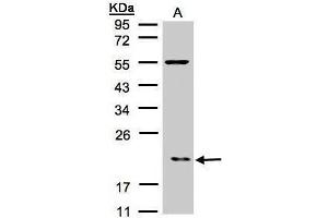 Western Blotting (WB) image for anti-Actin Related Protein 2/3 Complex, Subunit 3, 21kDa (ARPC3) antibody (ABIN2855247)