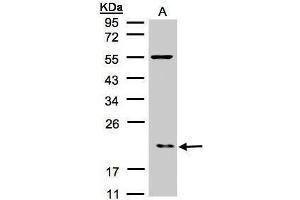 WB Image Sample(30 μg of whole cell lysate) A:Raji , 12% SDS PAGE antibody diluted at 1:500 (ARPC3 抗体)