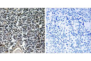 Peptide - +Immunohistochemistry analysis of paraffin-embedded human thymus gland tissue using ABCB7 antibody. (ABCB7 抗体)