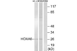 Western blot analysis of extracts from HT-29 cells and K562 cells, using HOXA6 antibody. (HOXA6 抗体  (Internal Region))