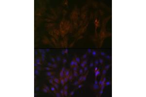 Immunofluorescence analysis of C6 cells using 15-PGDH/HPGD Rabbit mAb (ABIN7267807) at dilution of 1:100 (40x lens). (HPGD 抗体)