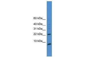 Western Blot showing PSCA antibody used at a concentration of 1-2 ug/ml to detect its target protein. (PSCA 抗体  (C-Term))