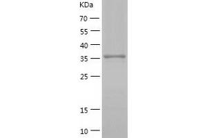 Western Blotting (WB) image for Uroporphyrinogen Decarboxylase (UROD) (AA 1-367) protein (His-IF2DI Tag) (ABIN7125669)