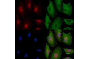 Phospho-YAP (Ser941) Antibody staining A549 cells(4h of LPS treatment) by IF/ICC. (YAP1 抗体  (pSer941))