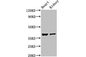 Western Blot Positive WB detected in: Mouse heart tissue, Mouse kidney tissue All lanes: NEUROD1 antibody at 4 μg/mL Secondary Goat polyclonal to rabbit IgG at 1/50000 dilution Predicted band size: 40 kDa Observed band size: 40 kDa (NEUROD1 抗体  (AA 154-356))